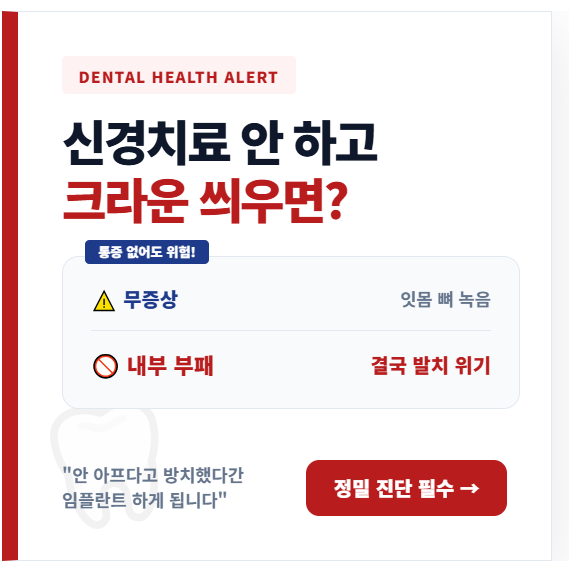 신경치료 없이 크라운 치료 시 잇몸 뼈 소실 위험 경고