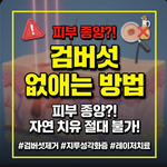 검버섯 없애는 방법