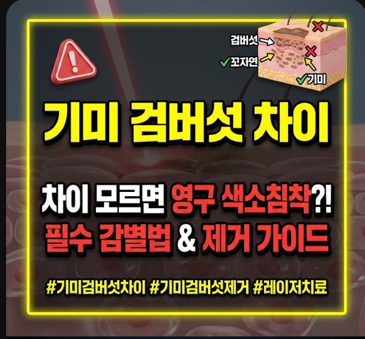 기미 검버섯 차이