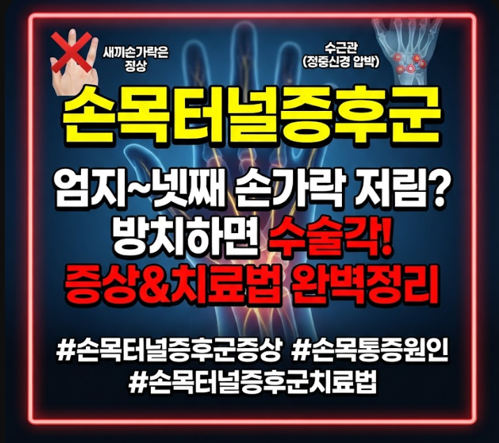 손목터널증후군 증상