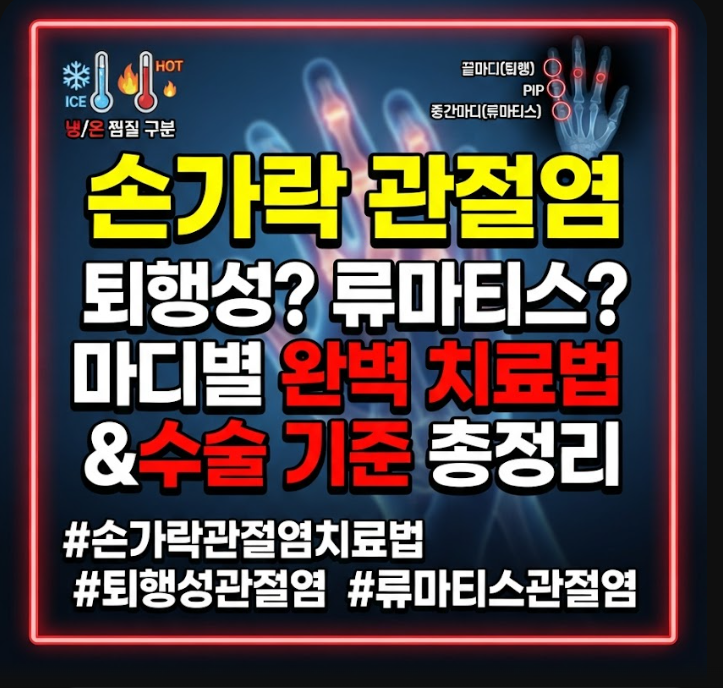 손가락 관절염 치료법