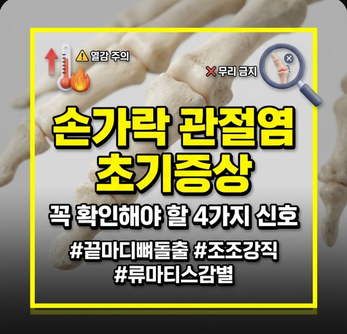 손가락 관절염 증상