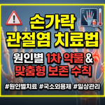손가락 관절염 치료법